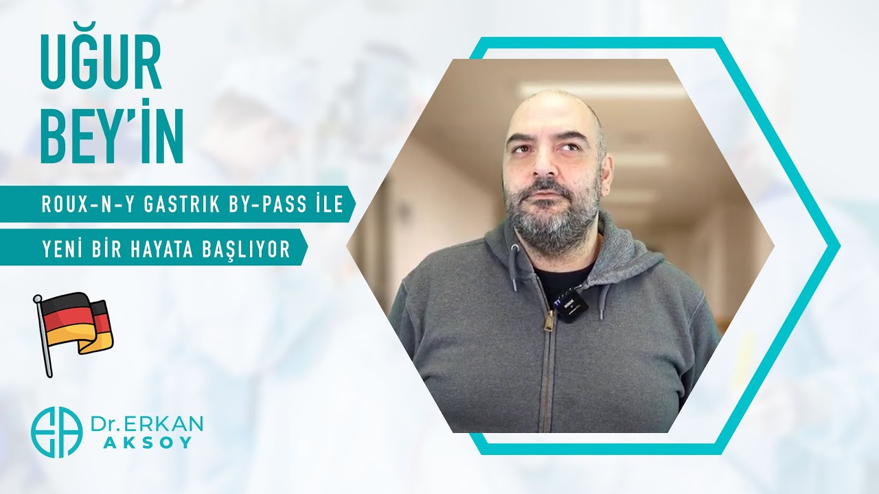Mr. Uğur from Frankfurt, Germany, is starting a new life with Roux-n-Y Gastric Bypass.
